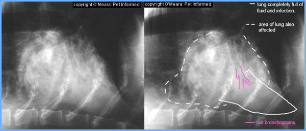 levaquin for aspiration pneumonia