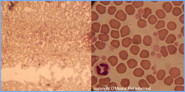 Image 1 is a low-power microscope
view of a blood smear with a very high white blood cell count. See all the darker purple dots? These are
all white blood cells. Image 2 is a normal blood smear showing
numerous red blood cells, a white blood cell (neutrophil) at the left edge of the image and many platelets. The platelets
are the smallest, paler pink dots in the image.
