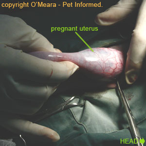 Pregnancy Operation