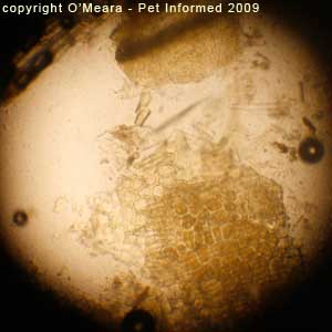 Fecal float parasite pictures - plant material.