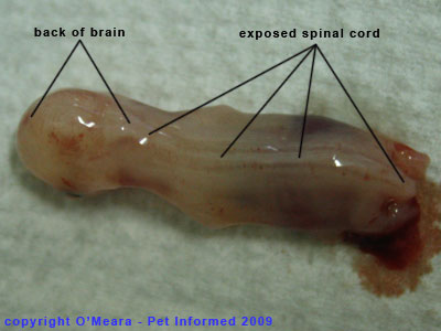 developing fetus stages