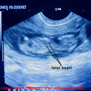 when does a fetus have a heartbeat when does a fetus have a heartbeat