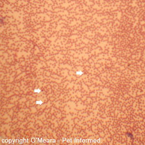 This is a blood smear taken at low factors to show a very low white blood cell count. It was difficult to find white blood cells (purple dots marked with arrows) anywhere in this image. The other plentiful pink cells are red blood cells.