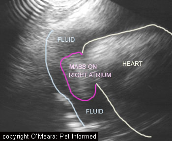 This is an ultrasound image of a pericardial sac haemorrhage. In this case, the animal did not have a bleeding disorder like rodenticide poison. It had a cancer (haemangiosarcoma) growing from the wall of its right atrium heart chamber. This tumour had ruptured and haemorrhaged blood into the sac around the heart.