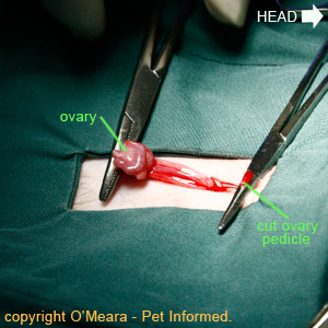 The ovarian pedicle has been cut with the scalpel.