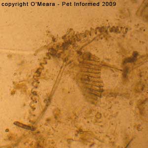 Fecal flotation parasite pictures - plant material.