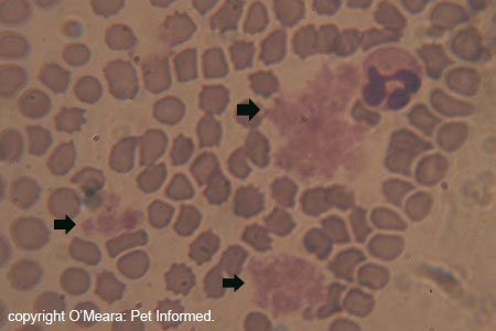 Platelet clumps or platelet plugs (indicated with black arrows) as seen in a blood smear.
