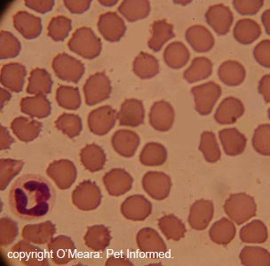This is the kind of image that might be seen in a case of DIC or ITP. There are no platelets in this blood smear.