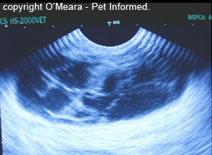 This is the appearance of a large seroma on ultrasound. Seromas are fluid-filled spaces (the black pockets are fluid) interlaced with connective tissue, fat and fibrin (the fine, white, lacy lines).