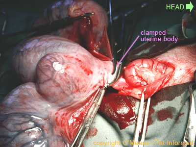 Hemostats are placed over the uterine body.