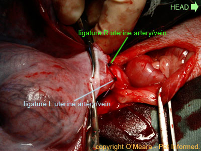 Two Horned Uterus