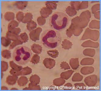 The two cells with the horseshoe shaped
nuclei are bands: immature neutrophils released into the blood in times of high infection.