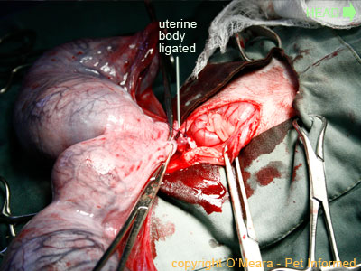Hole In Uterus