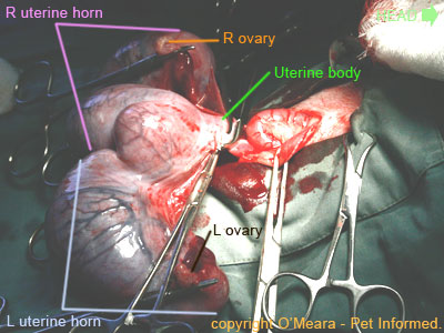 Two Horned Uterus