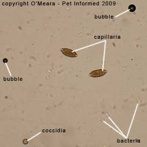 Fecal float parasite pictures - background of bacterial soup.