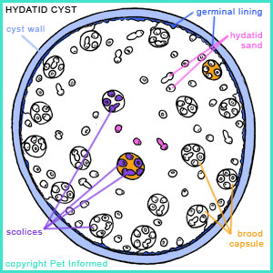 The structure of a unilocular hydatid cyst - Echinococcus granulosus.