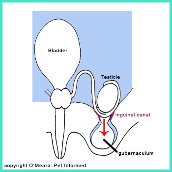 Testicular descent. The gubernaculum is contracting, dragging the testis from where it hangs within the abdominal cavity, through the inguinal canal and into the scrotal sac.